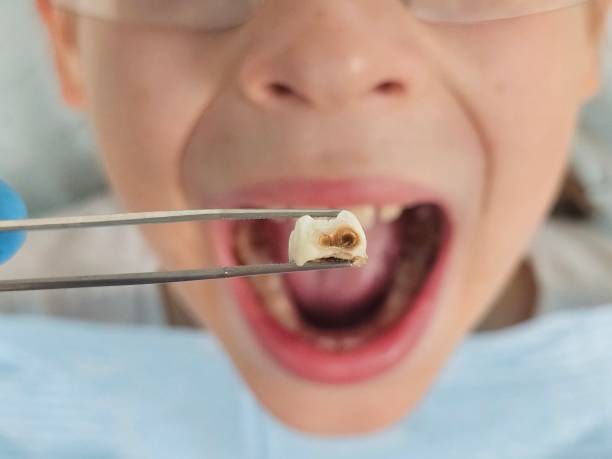 Best Urgent Tooth Repair  in Lake Geneva, WI