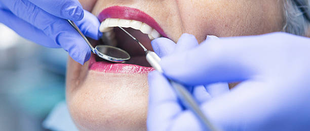 Best Knocked-Out Tooth Emergency  in Lake Geneva, WI